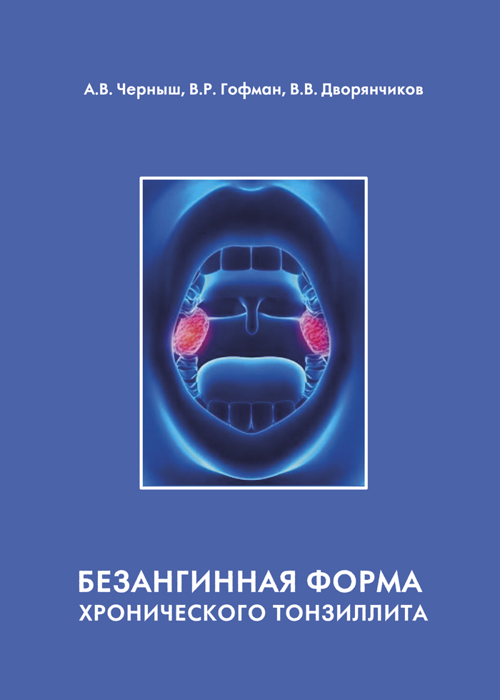 Безангинная форма хронического тонзиллита ISBN 978-5-94836-558-9