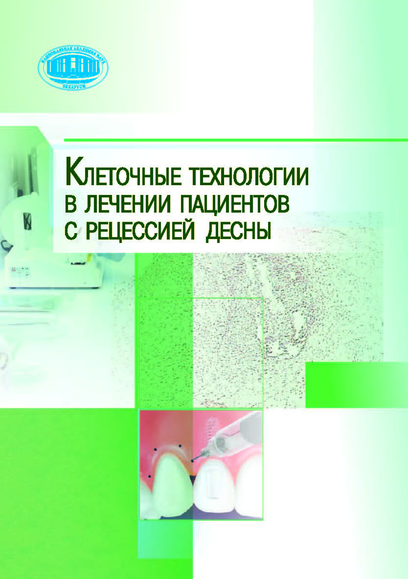 Клеточные технологии в лечении пациентов с рецессией десны ISBN 978-985-08-2410-3